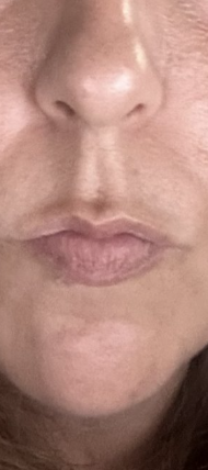 After treatment